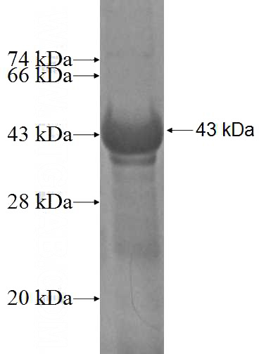 Recombinant Human FBXO18 SDS-PAGE