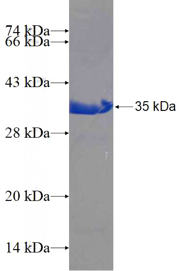 Recombinant Human SAFB SDS-PAGE