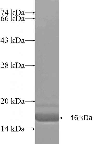 Recombinant Human LUZP2 SDS-PAGE