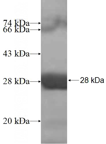 Recombinant Human SAR1B SDS-PAGE
