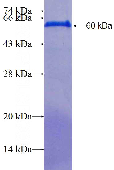 Recombinant Human CENPJ SDS-PAGE