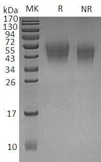 Human CD226/DNAM1 (His tag) recombinant protein