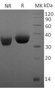 Human CD274/B7H1/PDCD1L1/PDCD1LG1/PDL1 (His tag) recombinant protein