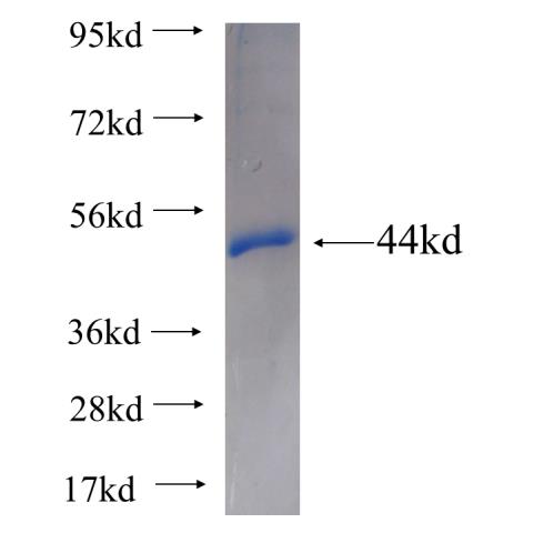Recombinant human ARIH2 SDS-PAGE