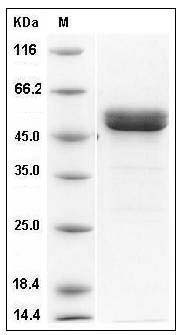 Human MMP1 Protein (His Tag) SDS-PAGE