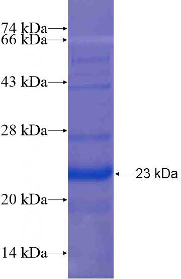 Recombinant Human ZG16B SDS-PAGE