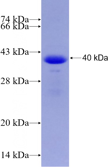 Recombinant Human GAA SDS-PAGE