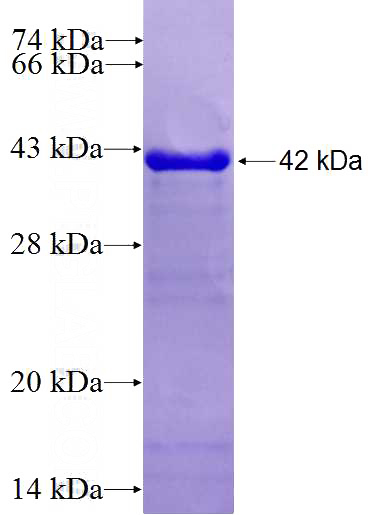 Recombinant Human KIBRA SDS-PAGE