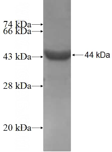 Recombinant Human HPS4 SDS-PAGE