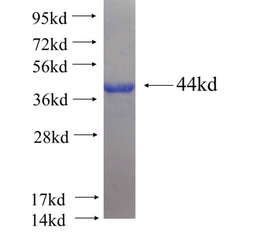 Recombinant human KLHL21 SDS-PAGE