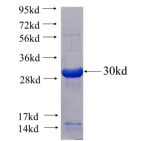 Recombinant Arabidopsis thaliana GNAT9 SDS-PAGE