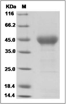 Human NRG1-beta 1 Protein () SDS-PAGE