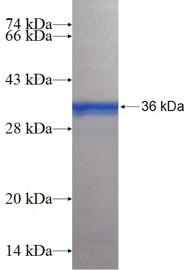 Recombinant Human PITPNM1 SDS-PAGE