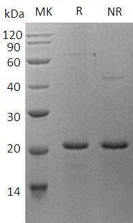 Human SIT1/SIT (His tag) recombinant protein