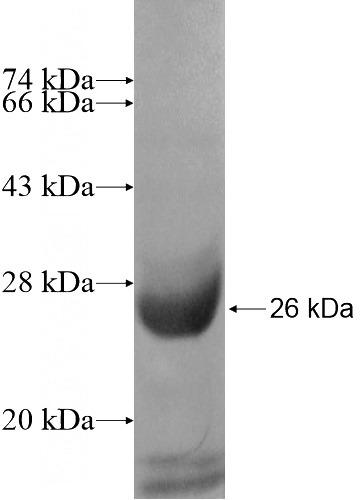 Recombinant Human TADA2B SDS-PAGE