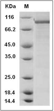 Human PDE1C Protein (His & GST Tag) SDS-PAGE
