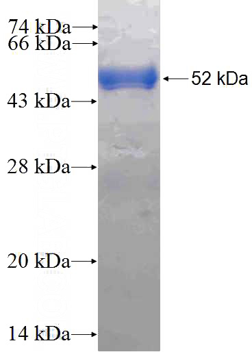 Recombinant Human RAB3C SDS-PAGE