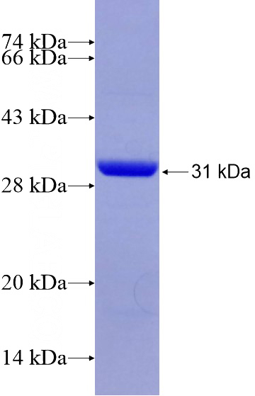 Recombinant Human ISYNA1 SDS-PAGE