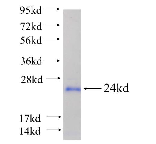 Recombinant human SRGAP2 SDS-PAGE