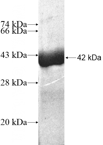 Recombinant Human HBM SDS-PAGE