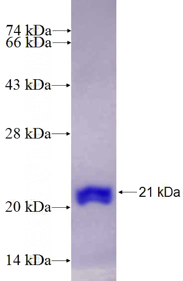 Recombinant Human UQCC SDS-PAGE