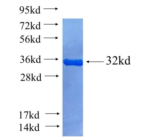 Recombinant human AXIN2 SDS-PAGE