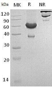 Mouse Efna1/Epgl1/Epl1/Lerk1 (Fc & His tag) recombinant protein