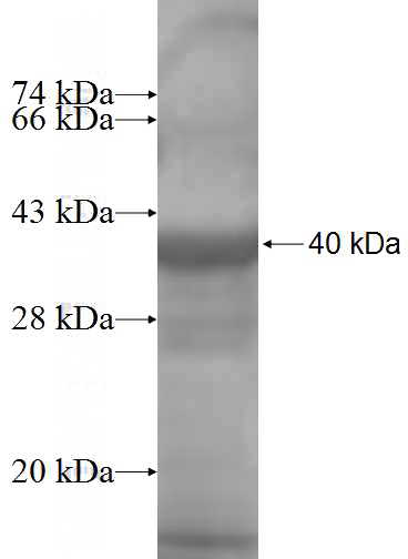 Recombinant Human ARPC2 SDS-PAGE