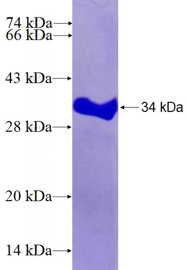 Recombinant Human PLD2 SDS-PAGE