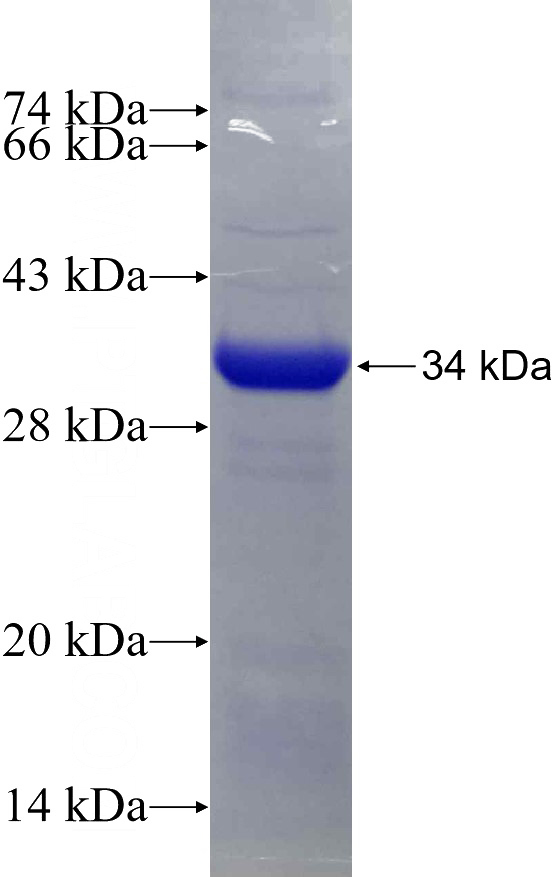 Recombinant Human RNASEH2A SDS-PAGE