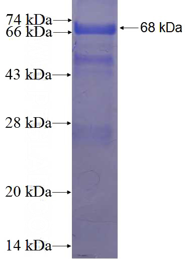 Recombinant Human SMARCAL1 SDS-PAGE