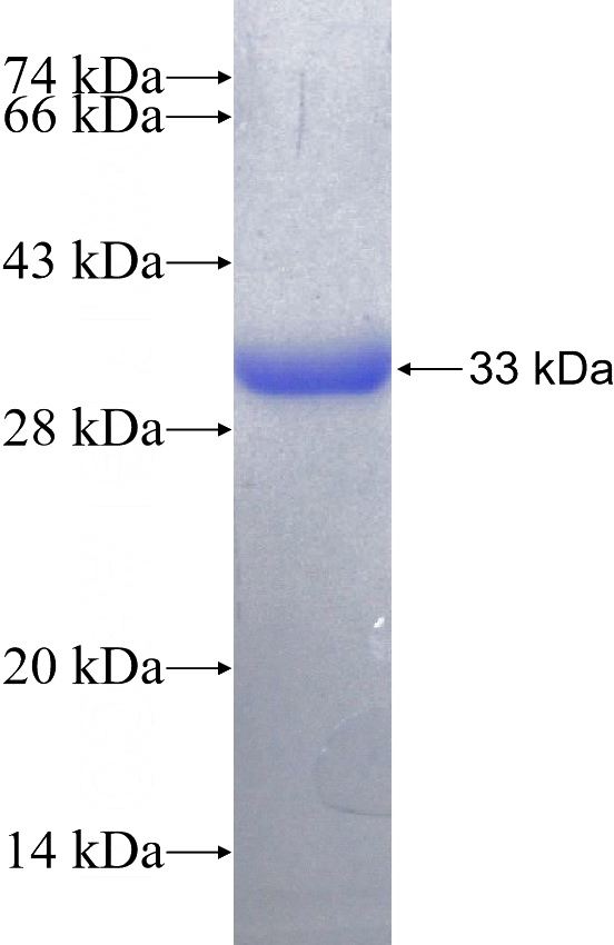 Recombinant Human PMEPA1 SDS-PAGE