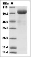 Human VEGFR1 / FLT-1 Protein (Fc Tag) SDS-PAGE