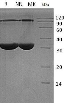 Human SDCBP/MDA9/SYCL (His tag) recombinant protein