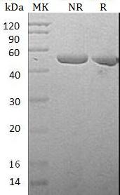 Mouse Serpine1/Mr1/Pai1/Planh1 (His tag) recombinant protein