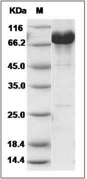 Human NCF-2 / NCF2 / P67phox Protein (His & GST Tag) SDS-PAGE