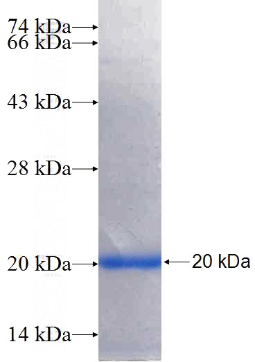 Recombinant Human AQP10 SDS-PAGE