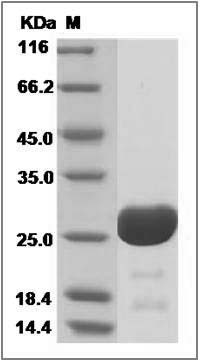Human Immunodeficiency Virus type 1 (HIV-1) Gag-p24 Protein (group O, His Tag) SDS-PAGE