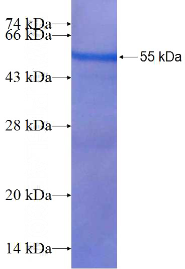 Recombinant Human MAP1S SDS-PAGE