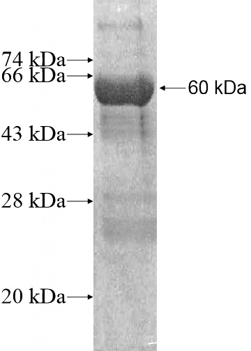 Recombinant Human GPD1L SDS-PAGE