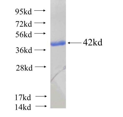 Recombinant human MAT2B(Full length) SDS-PAGE