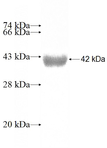 Recombinant Human MANBA SDS-PAGE
