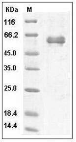 Human Noggin / NOG Protein (Fc Tag) SDS-PAGE