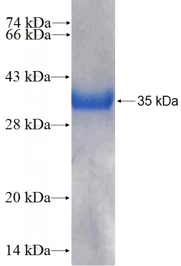 Recombinant Human RAB5B SDS-PAGE