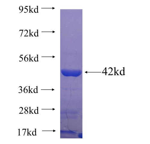 Recombinant human KANK4 SDS-PAGE