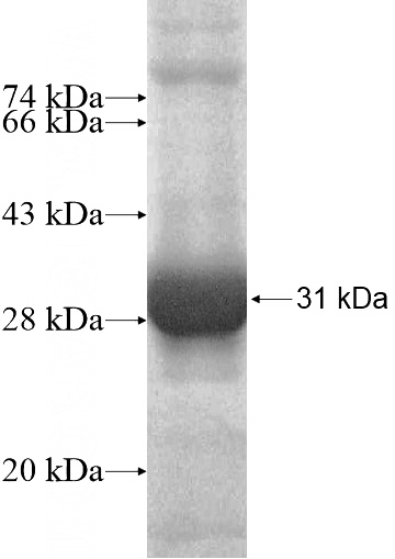 Recombinant Human DDX47 SDS-PAGE