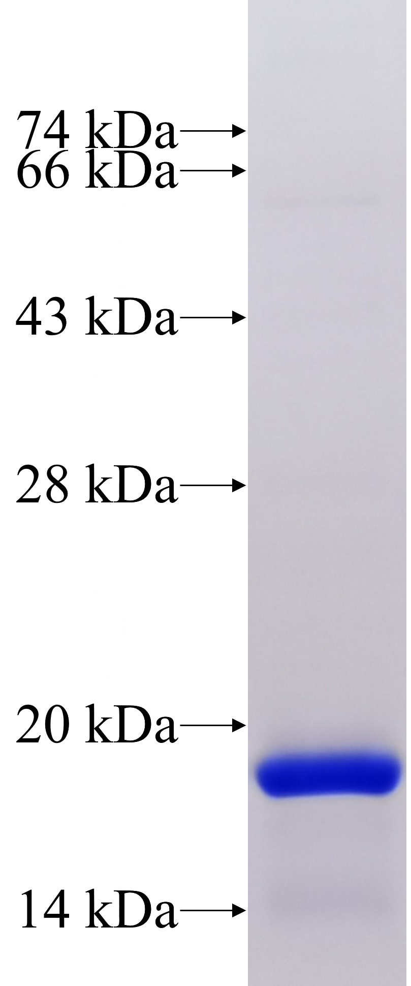 Recombinant Human SFTPA1 SDS-PAGE