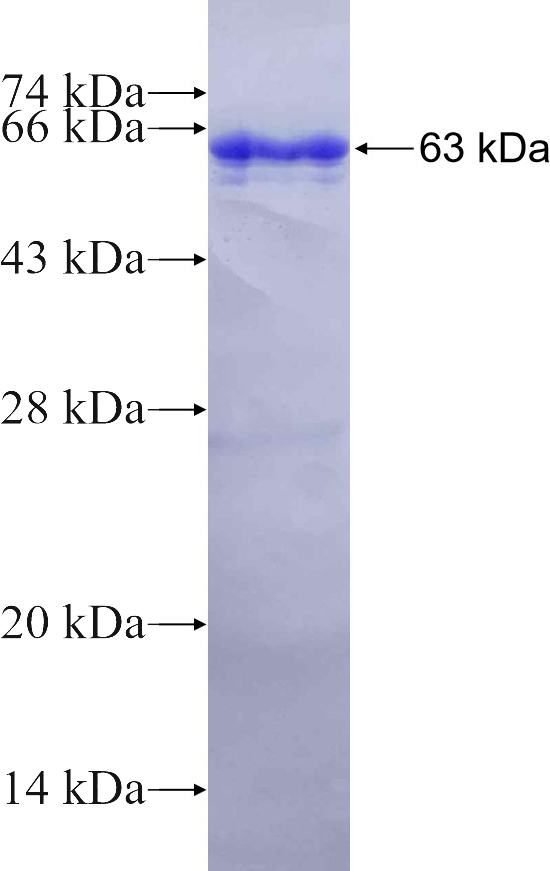 Recombinant human ARL13B SDS-PAGE