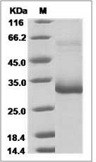 Mouse MBL-2 / MBL Protein (His Tag)