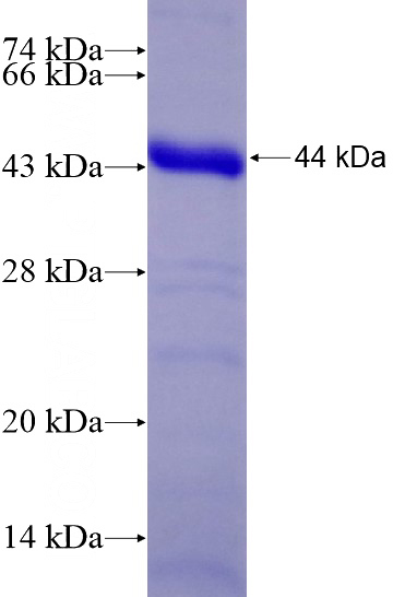 Recombinant Human NBN SDS-PAGE